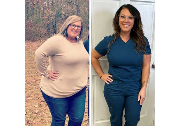 Kimber's before and after weight loss surgery